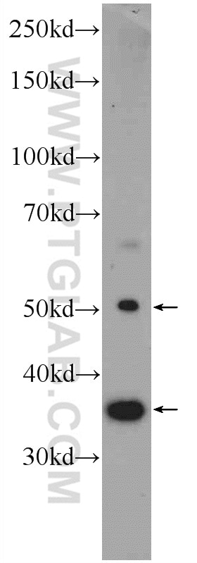 Western Blot (WB) analysis of Jurkat cells using human IgG heavy chain Polyclonal antibody (16402-1-AP)