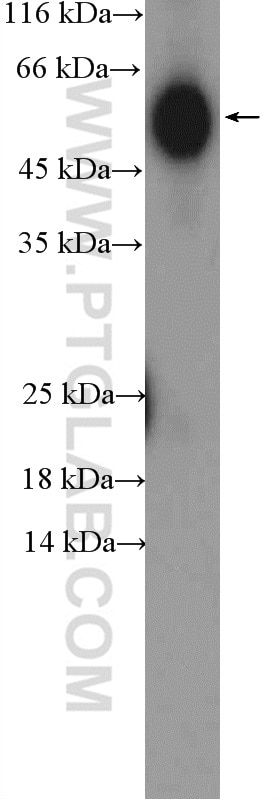 Western Blot (WB) analysis of human plasma using human IgG heavy chain Polyclonal antibody (16402-1-AP)