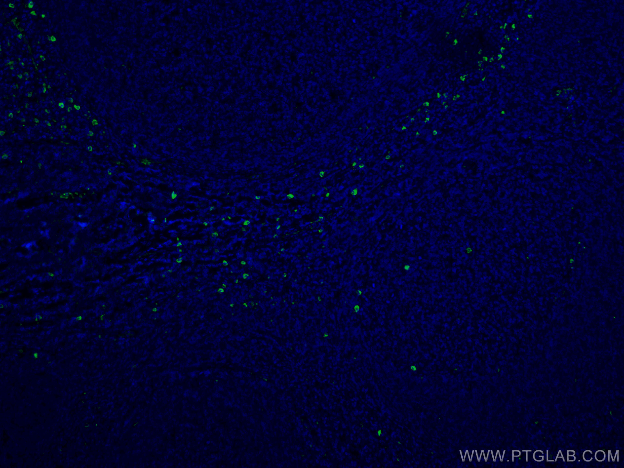 Immunofluorescence (IF) / fluorescent staining of human tonsillitis tissue using Human IgG4 Monoclonal antibody (66408-1-Ig)