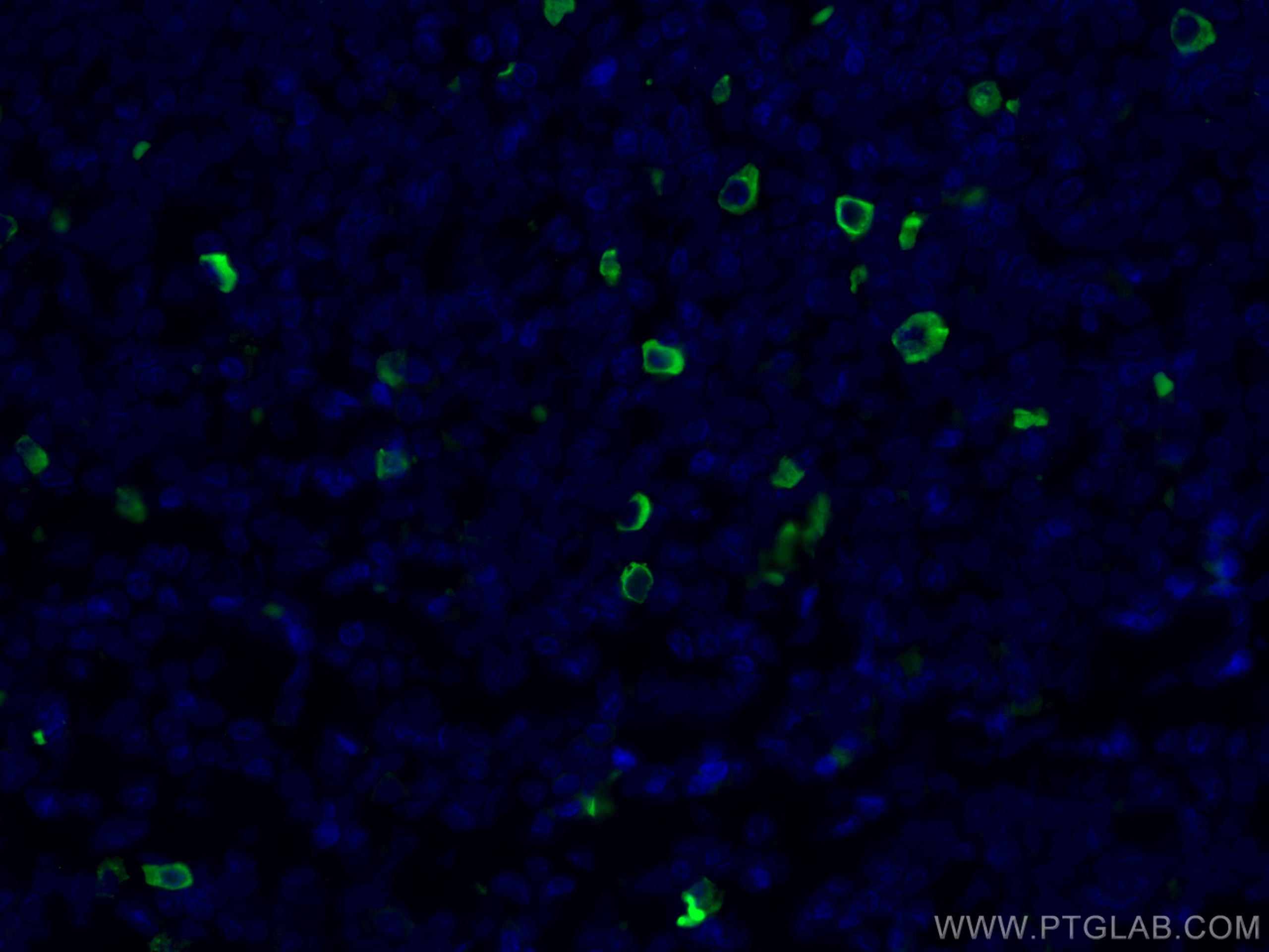 Immunofluorescence (IF) / fluorescent staining of human tonsillitis tissue using Human IgG4 Monoclonal antibody (66408-1-Ig)