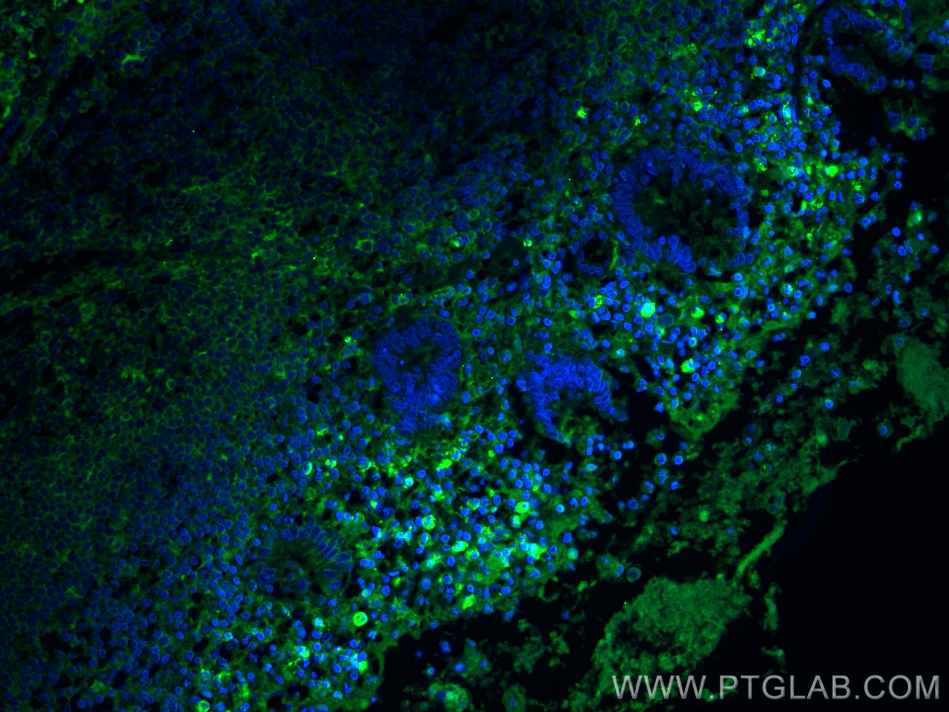 Immunofluorescence (IF) / fluorescent staining of human appendicitis tissue using Human IgG4 Monoclonal antibody (66408-1-Ig)
