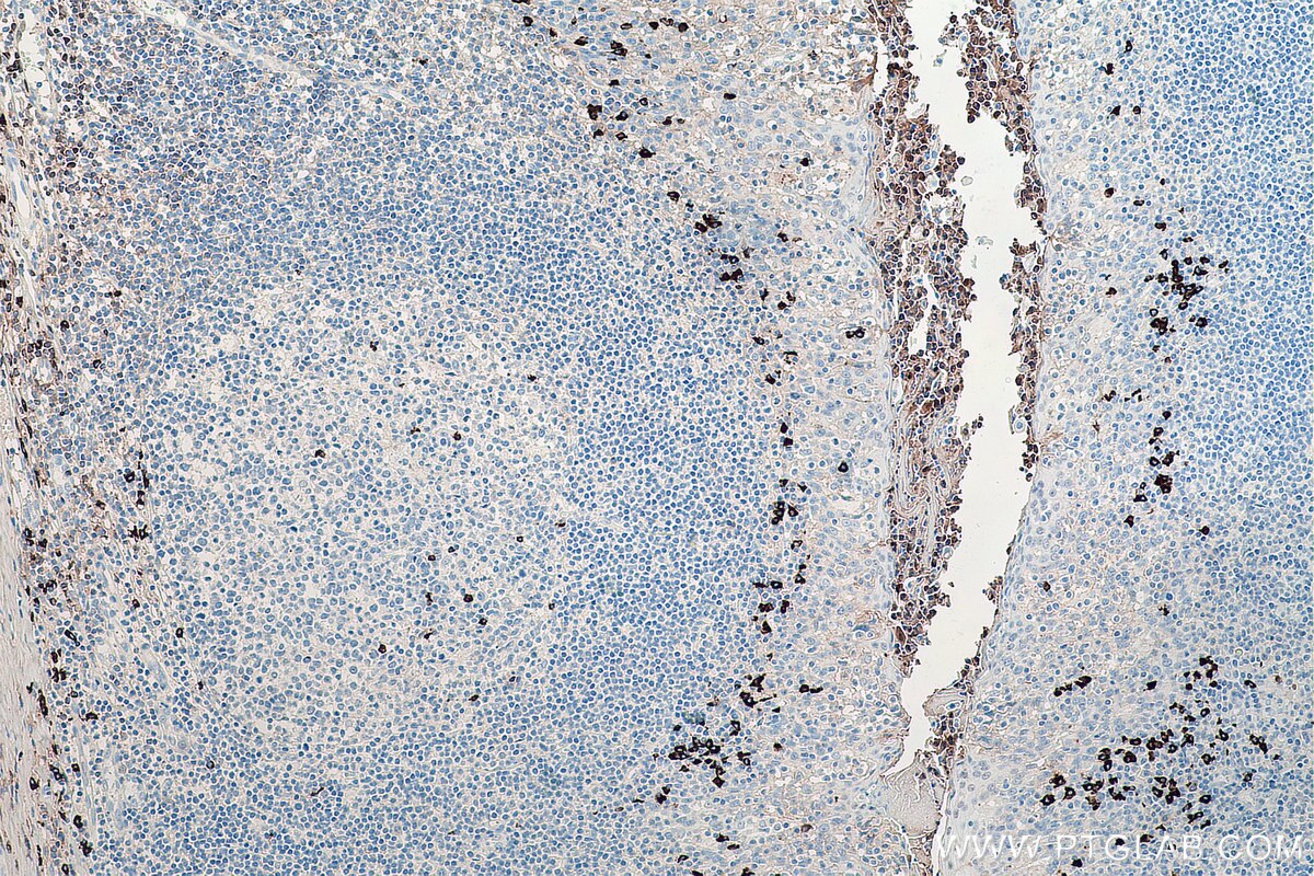 IHC staining of human tonsillitis using 66408-1-Ig Immunohistochemistry (IHC) staining of human tonsillitis tissue using Human IgG4 Monoclonal antibody (66408-1-Ig)
