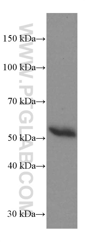Western Blot (WB) analysis of human plasma using Human IgG4 Monoclonal antibody (66408-1-Ig)