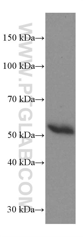 WB analysis of human plasma using 66408-1-Ig