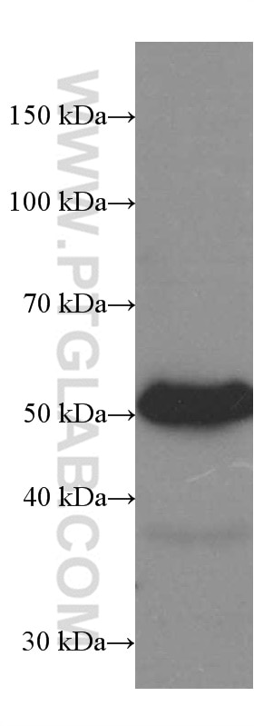 Western Blot (WB) analysis of human skeletal muscle tissue using Human IgG4 Monoclonal antibody (66408-1-Ig)