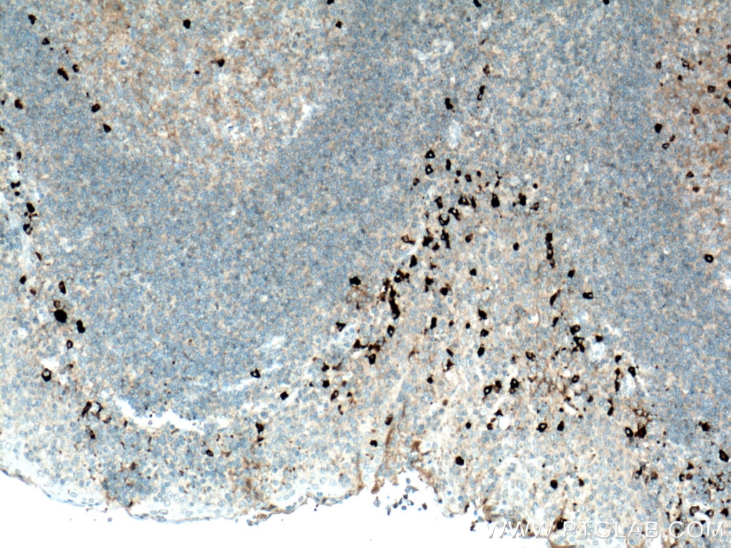 Immunohistochemistry (IHC) staining of human tonsillitis tissue using Biotin-conjugated Human IgG4 Monoclonal antibody (Biotin-66408)