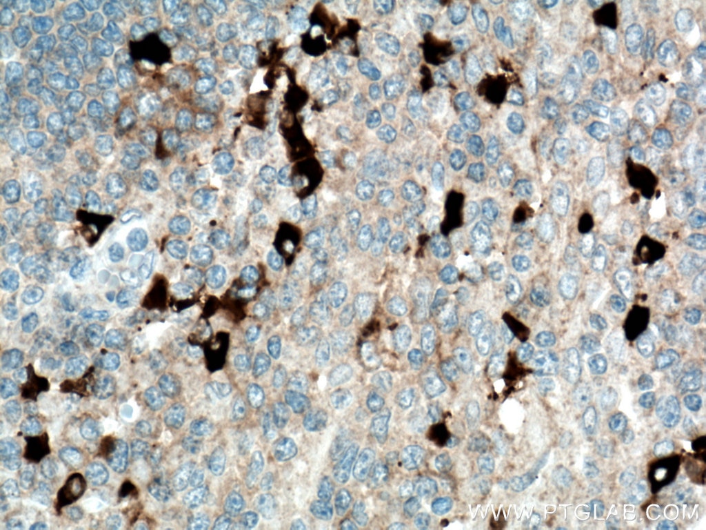 Immunohistochemistry (IHC) staining of human tonsillitis tissue using Biotin-conjugated Human IgG4 Monoclonal antibody (Biotin-66408)
