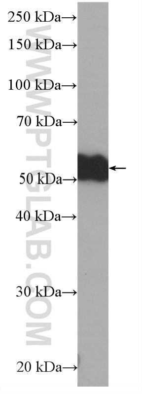 Western Blot (WB) analysis of human plasma using HRP-conjugated Human IgG4 Monoclonal antibody (HRP-66408)