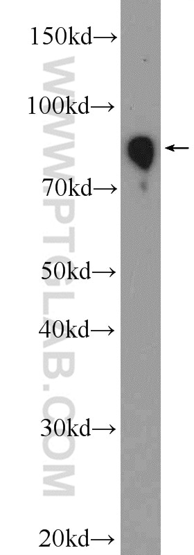 Western Blot (WB) analysis of human plasma using human IgM Polyclonal antibody (11016-1-AP)