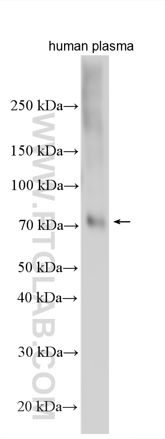Western Blot (WB) analysis of various lysates using human IgM Polyclonal antibody (11016-1-AP)