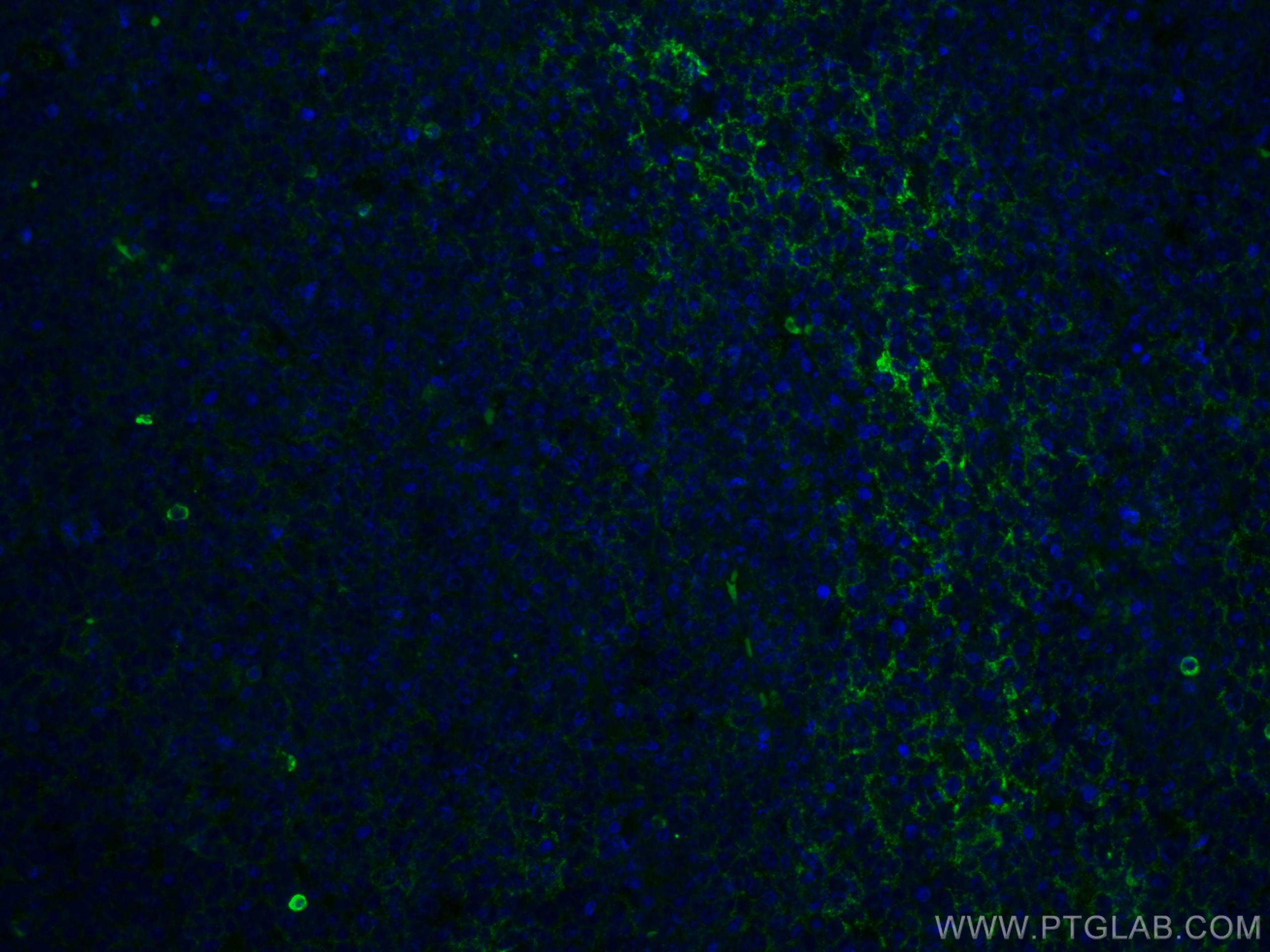 Immunofluorescence (IF) / fluorescent staining of human tonsillitis tissue using human IgM Monoclonal antibody (66484-1-Ig)