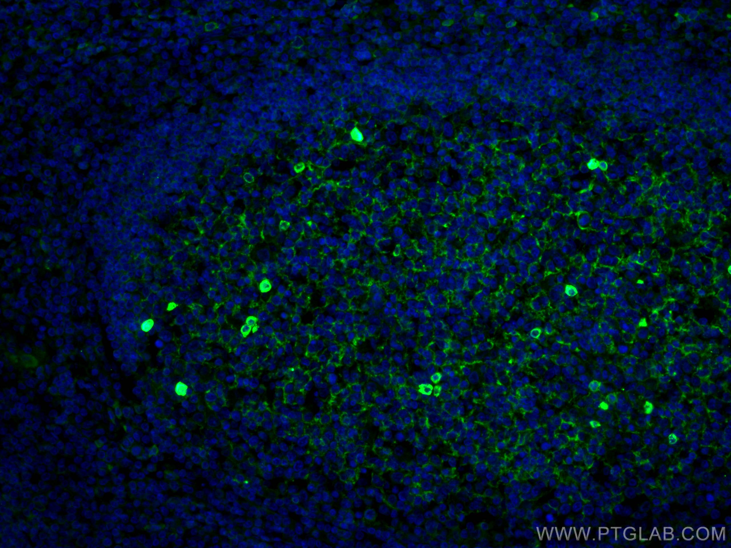 Immunofluorescence (IF) / fluorescent staining of human tonsillitis tissue using human IgM Monoclonal antibody (66484-1-Ig)