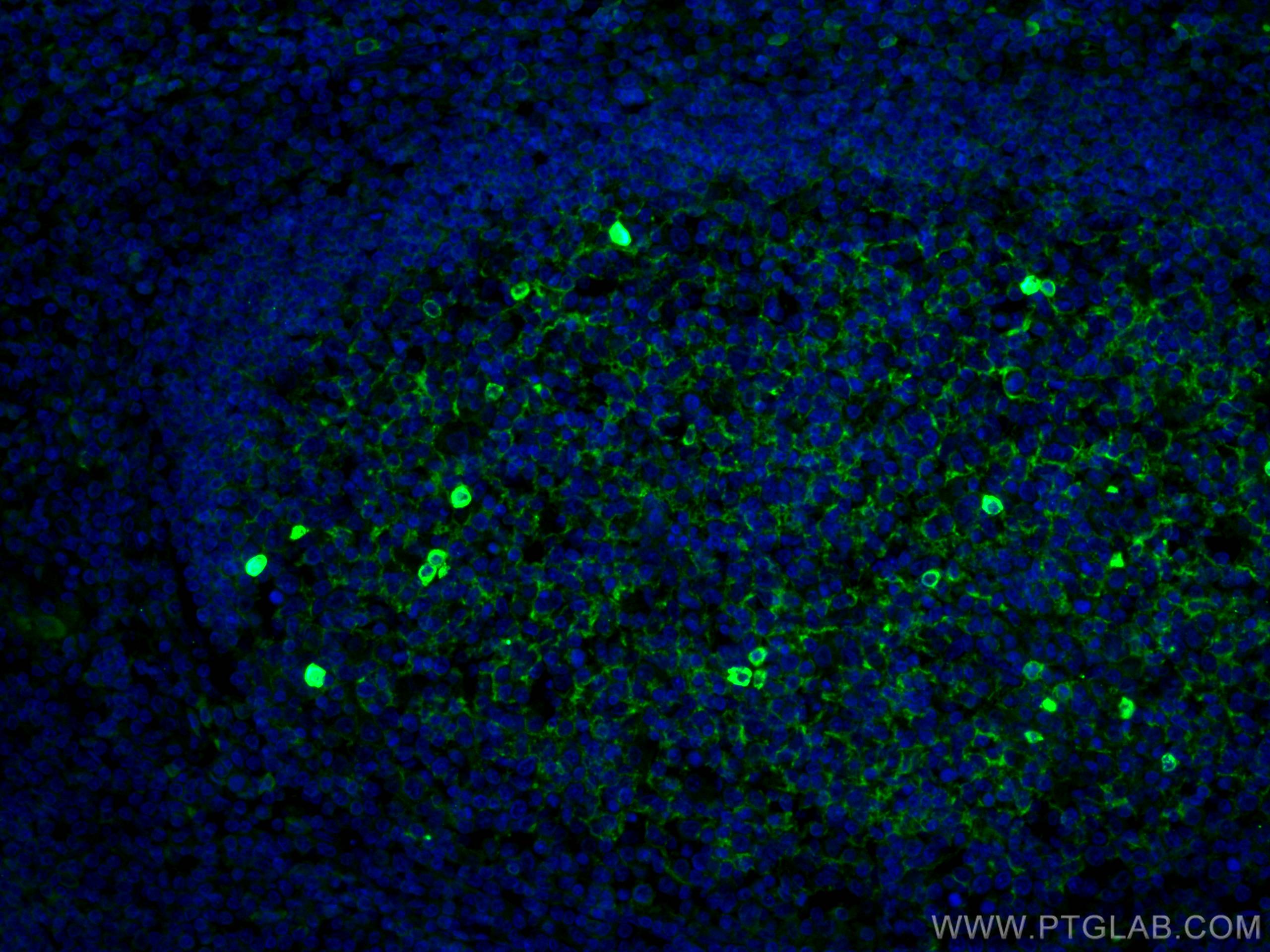 IF Staining of human tonsillitis using 66484-1-Ig