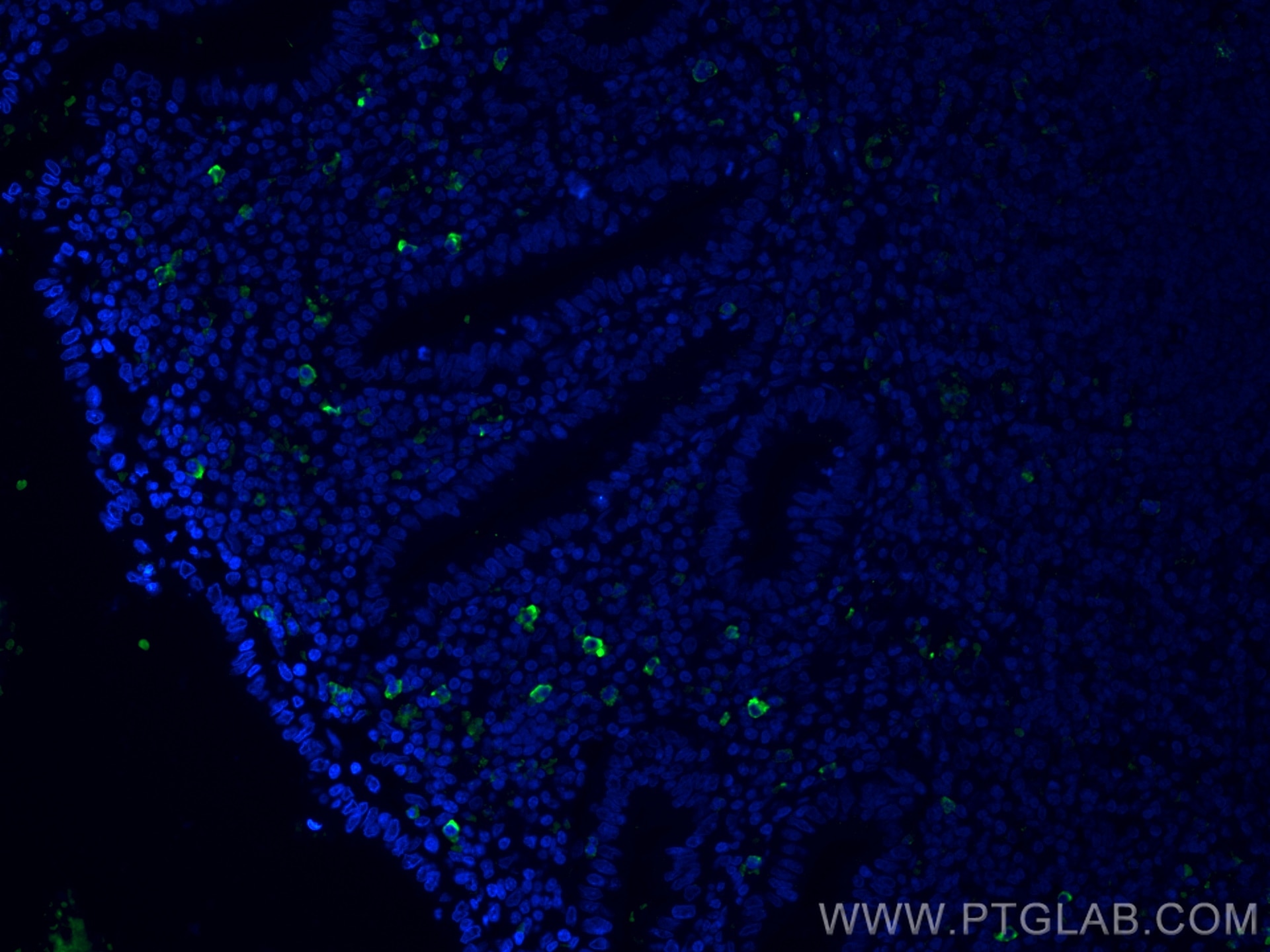 Immunofluorescence (IF) / fluorescent staining of human appendicitis tissue using human IgM Monoclonal antibody (66484-1-Ig)