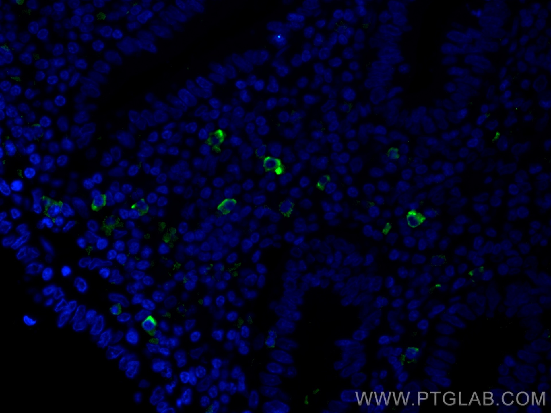 Immunofluorescence (IF) / fluorescent staining of human appendicitis tissue using human IgM Monoclonal antibody (66484-1-Ig)