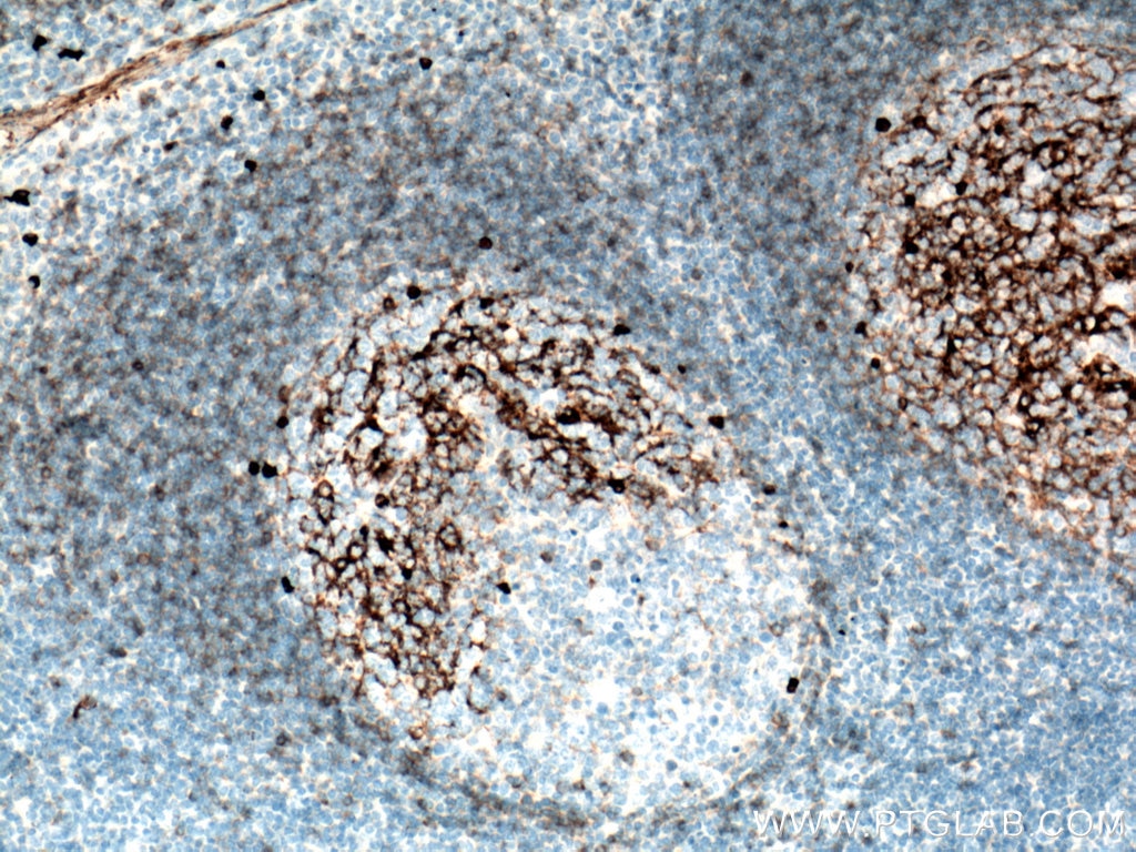 Immunohistochemistry (IHC) staining of human tonsillitis tissue using human IgM Monoclonal antibody (66484-1-Ig)