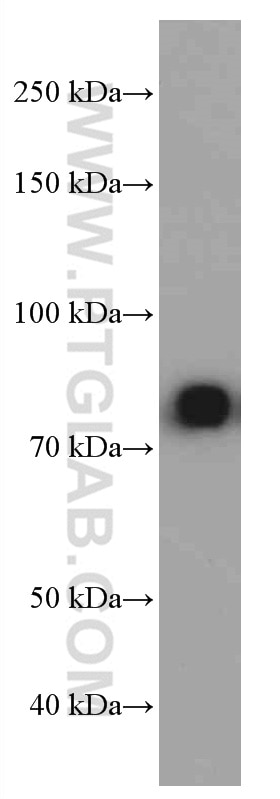 Western Blot (WB) analysis of Human plasma using human IgM Monoclonal antibody (66484-1-Ig)