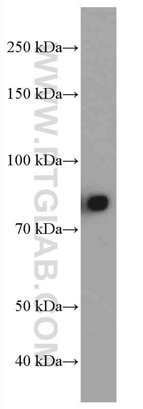 Western Blot (WB) analysis of Human plasma using human IgM Monoclonal antibody (66484-1-Ig)