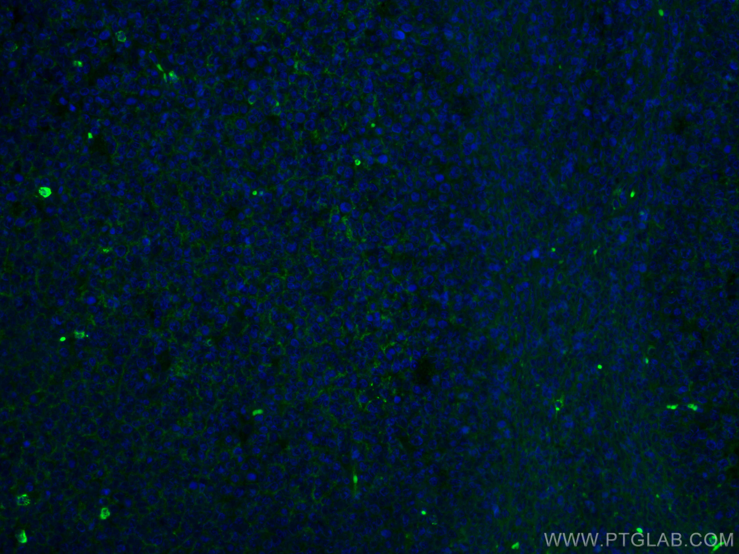 Immunofluorescence (IF) / fluorescent staining of human tonsillitis tissue using CoraLite® Plus 488-conjugated human IgM Monoclonal (CL488-66484)