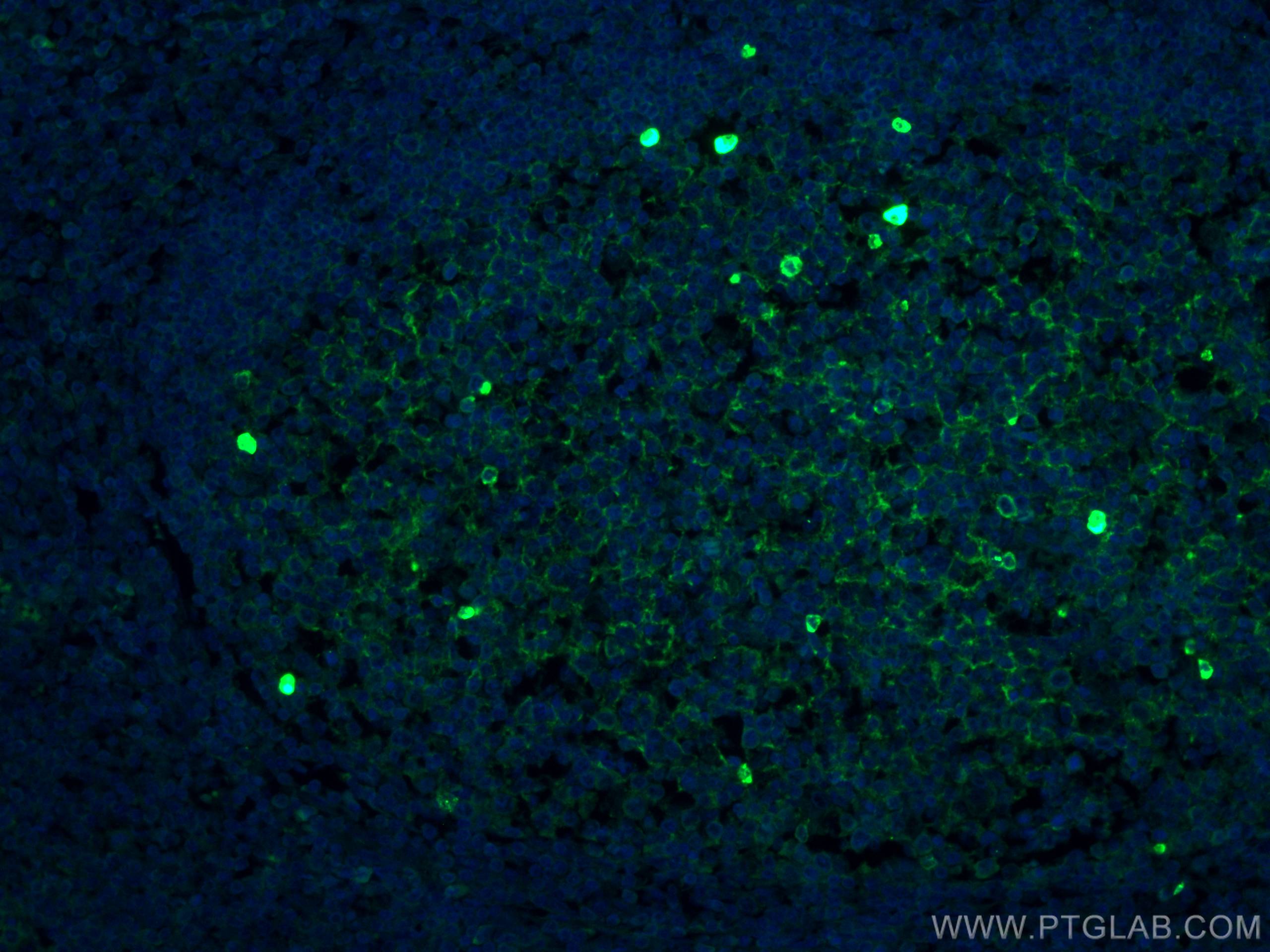 Immunofluorescence (IF) / fluorescent staining of human tonsillitis tissue using CoraLite®488-conjugated human IgM Monoclonal antib (CL488-66484)