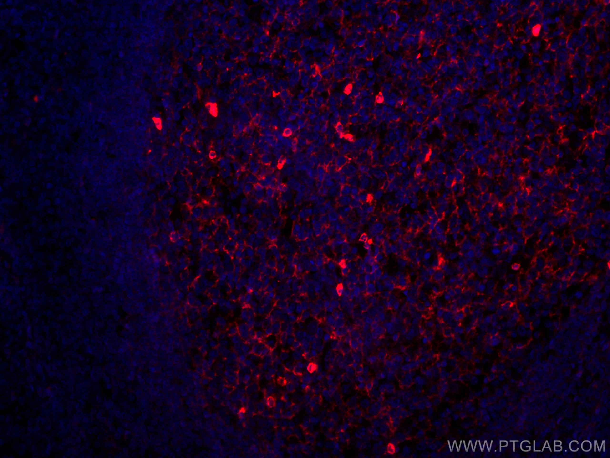 Immunofluorescence (IF) / fluorescent staining of human tonsillitis tissue using CoraLite®594-conjugated human IgM Monoclonal antib (CL594-66484)