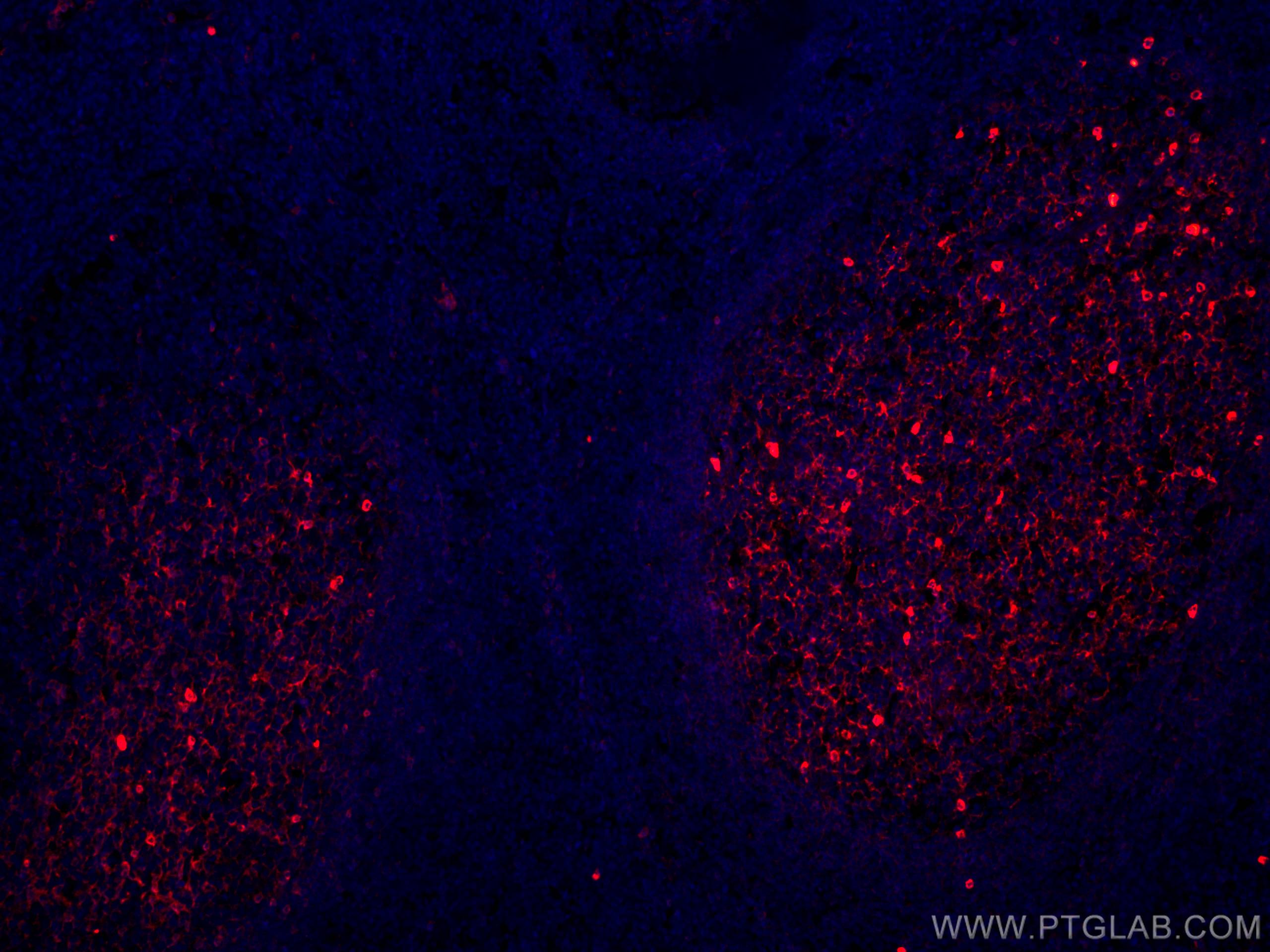 Immunofluorescence (IF) / fluorescent staining of human tonsillitis tissue using CoraLite®594-conjugated human IgM Monoclonal antib (CL594-66484)