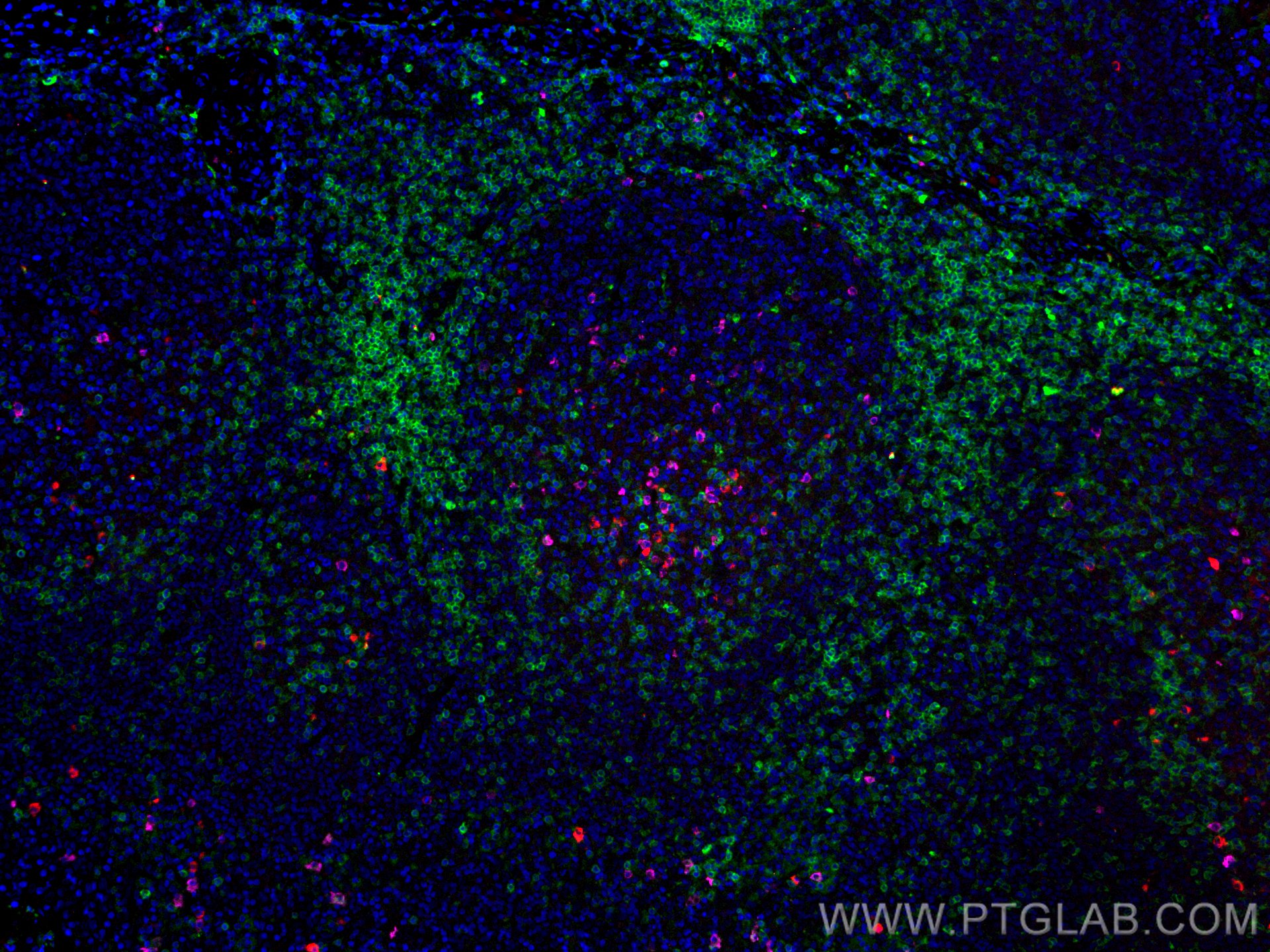 Immunofluorescence (IF) / fluorescent staining of human tonsillitis tissue using CoraLite®594-conjugated human IgM Monoclonal antib (CL594-66484)