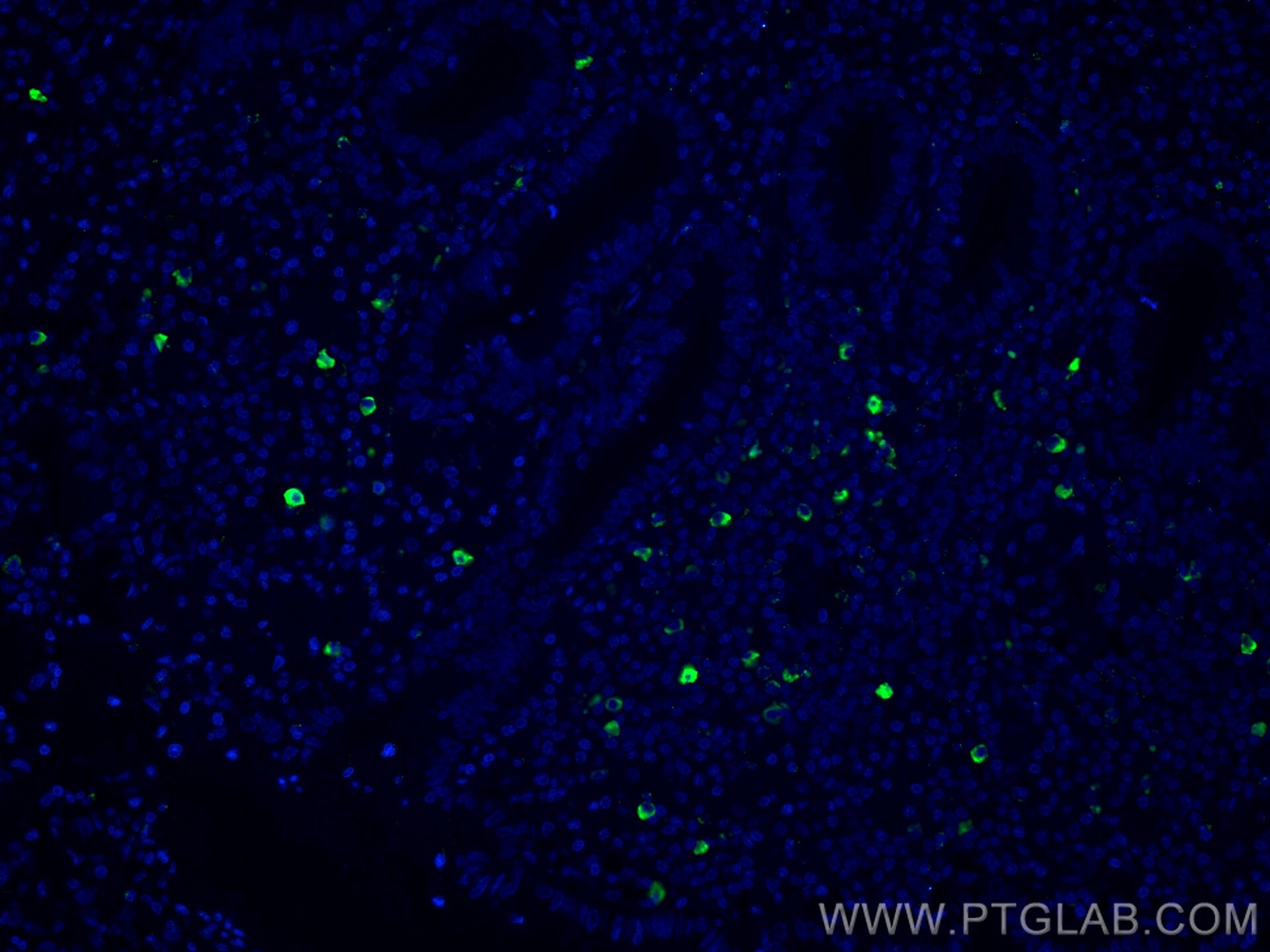 Immunofluorescence (IF) / fluorescent staining of human appendicitis tissue using CoraLite®594-conjugated human IgM Monoclonal antib (CL594-66484)