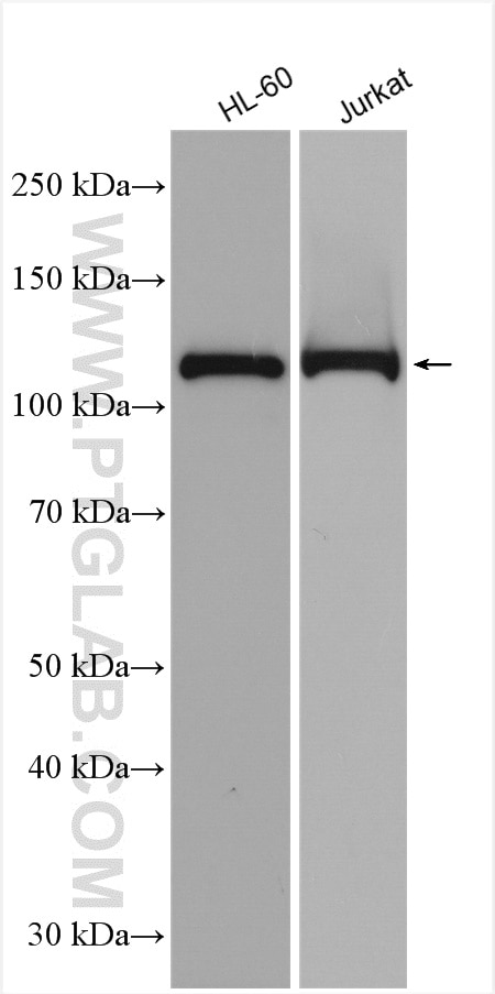 Western Blot (WB) analysis of various lysates using IGHMBP2 Polyclonal antibody (23945-1-AP)