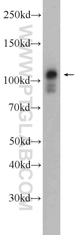 Western Blot (WB) analysis of human brain tissue using IGHMBP2 Polyclonal antibody (23945-1-AP)