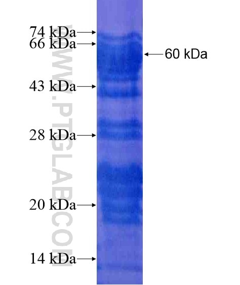 IGHMBP2 fusion protein Ag21057 SDS-PAGE