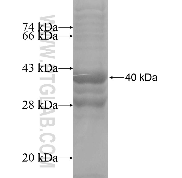 IGHV7-81 fusion protein Ag11082 SDS-PAGE