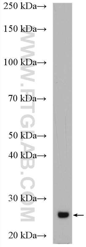 Western Blot (WB) analysis of human plasma using IGJ Polyclonal antibody (13688-1-AP)