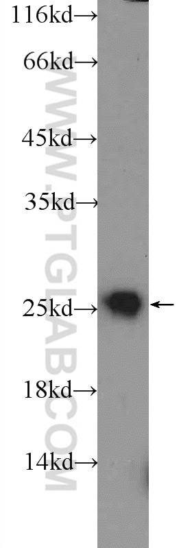 Western Blot (WB) analysis of mouse spleen tissue using IGJ Polyclonal antibody (13688-1-AP)