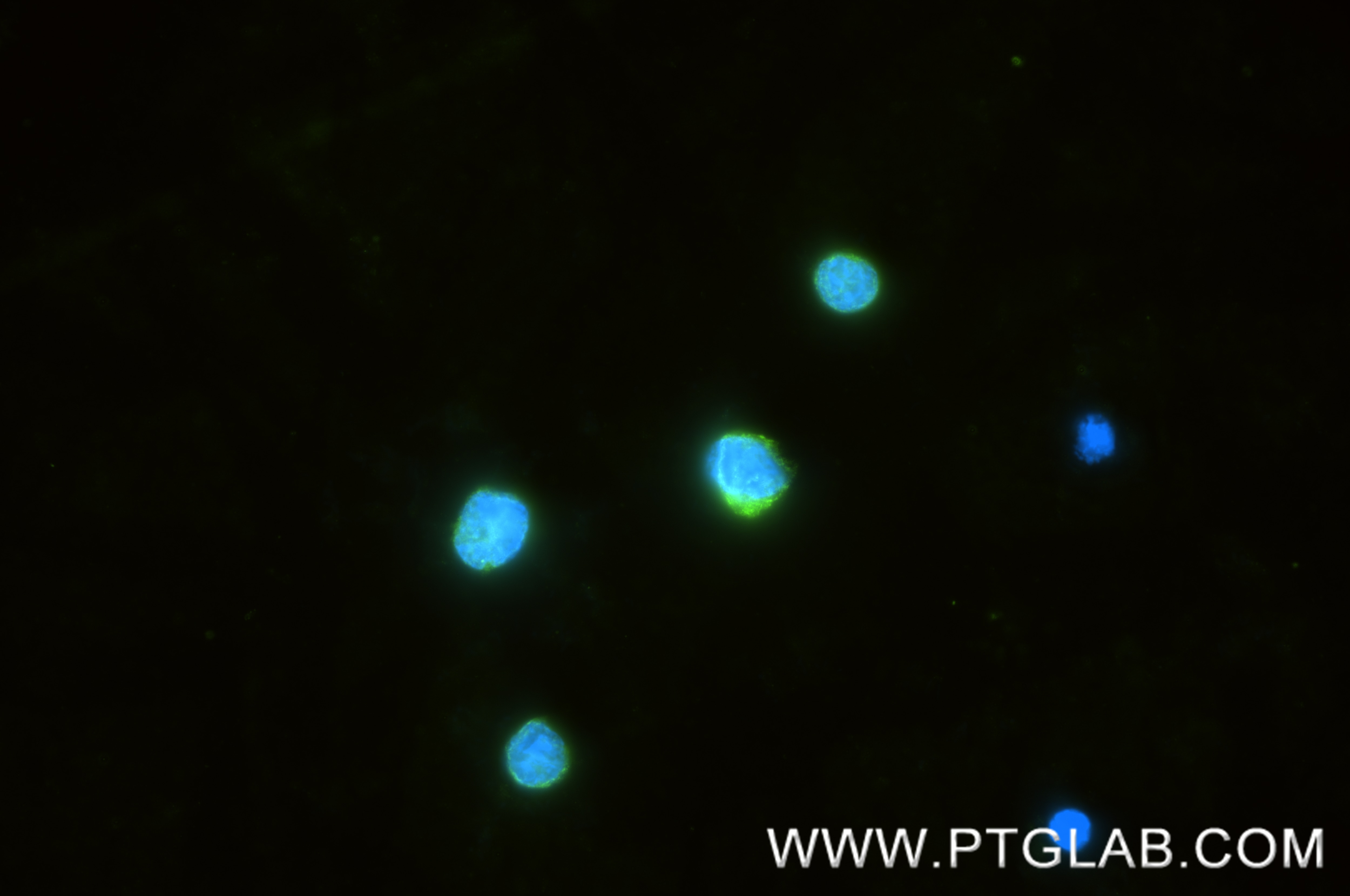 IF Staining of Ramos using 86939-1-RR (same clone as 86939-1-PBS) Immunofluorescence (IF) / fluorescent staining of Ramos cells using IGJ Recombinant monoclonal antibody (86939-1-RR)