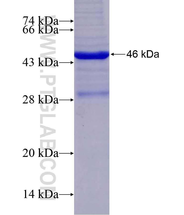IGJ fusion protein Ag4559 SDS-PAGE