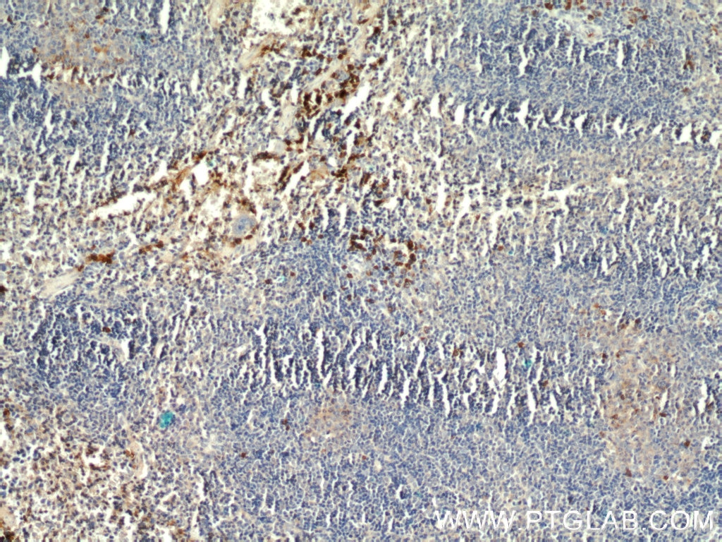 Immunohistochemistry (IHC) staining of mouse spleen tissue using IgG Kappa Light Chain Polyclonal antibody (14678-1-AP)