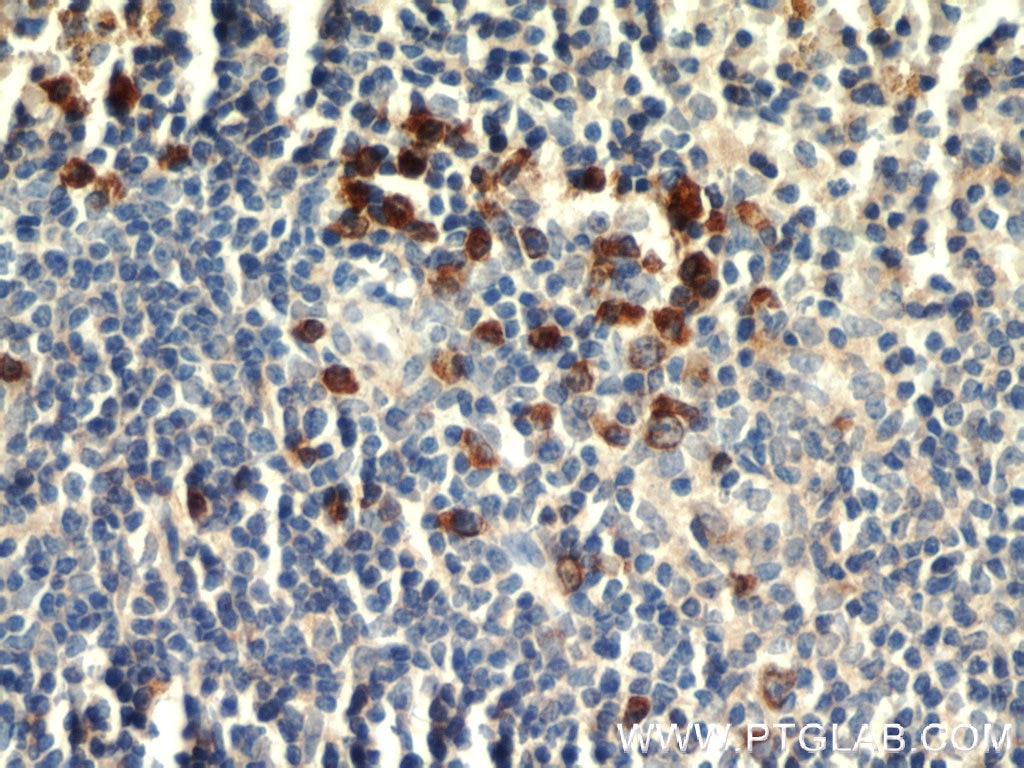 IHC staining of mouse spleen using 14678-1-AP