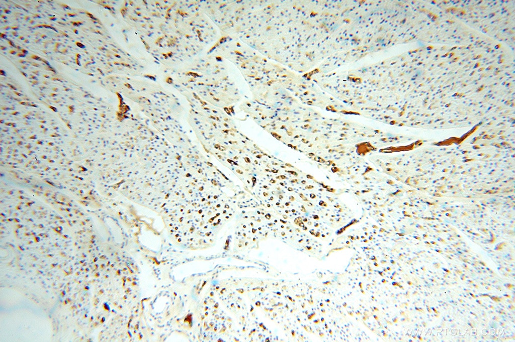 IHC staining of human heart using 14678-1-AP