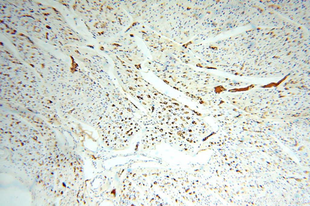 Immunohistochemistry (IHC) staining of human heart tissue using IgG Kappa Light Chain Polyclonal antibody (14678-1-AP)