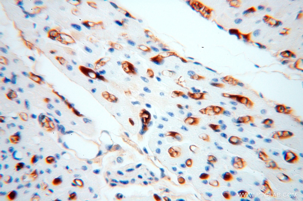 IHC staining of human heart using 14678-1-AP