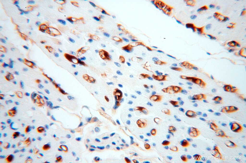 Immunohistochemistry (IHC) staining of human heart tissue using IgG Kappa Light Chain Polyclonal antibody (14678-1-AP)