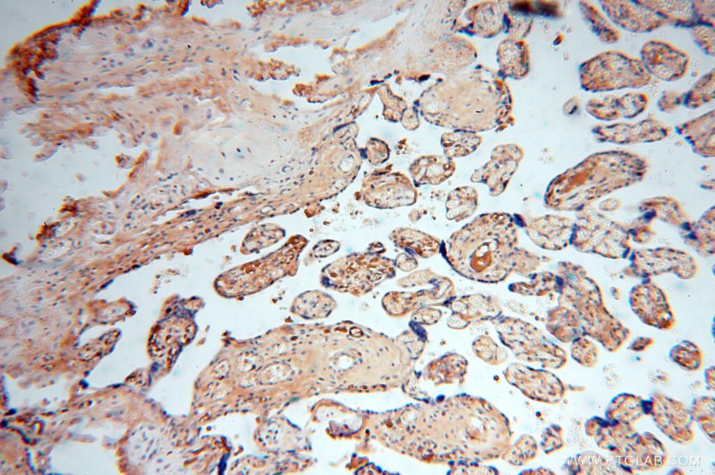 Immunohistochemistry (IHC) staining of human placenta tissue using IgG Kappa Light Chain Polyclonal antibody (14678-1-AP)