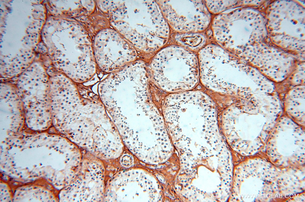 Immunohistochemistry (IHC) staining of human testis tissue using IgG Kappa Light Chain Polyclonal antibody (14678-1-AP)