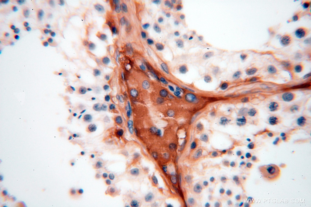 Immunohistochemistry (IHC) staining of human testis tissue using IgG Kappa Light Chain Polyclonal antibody (14678-1-AP)