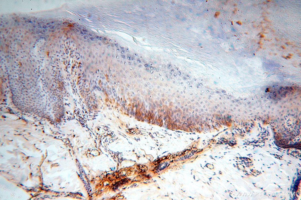 Immunohistochemistry (IHC) staining of human skin tissue using IgG Kappa Light Chain Polyclonal antibody (14678-1-AP)