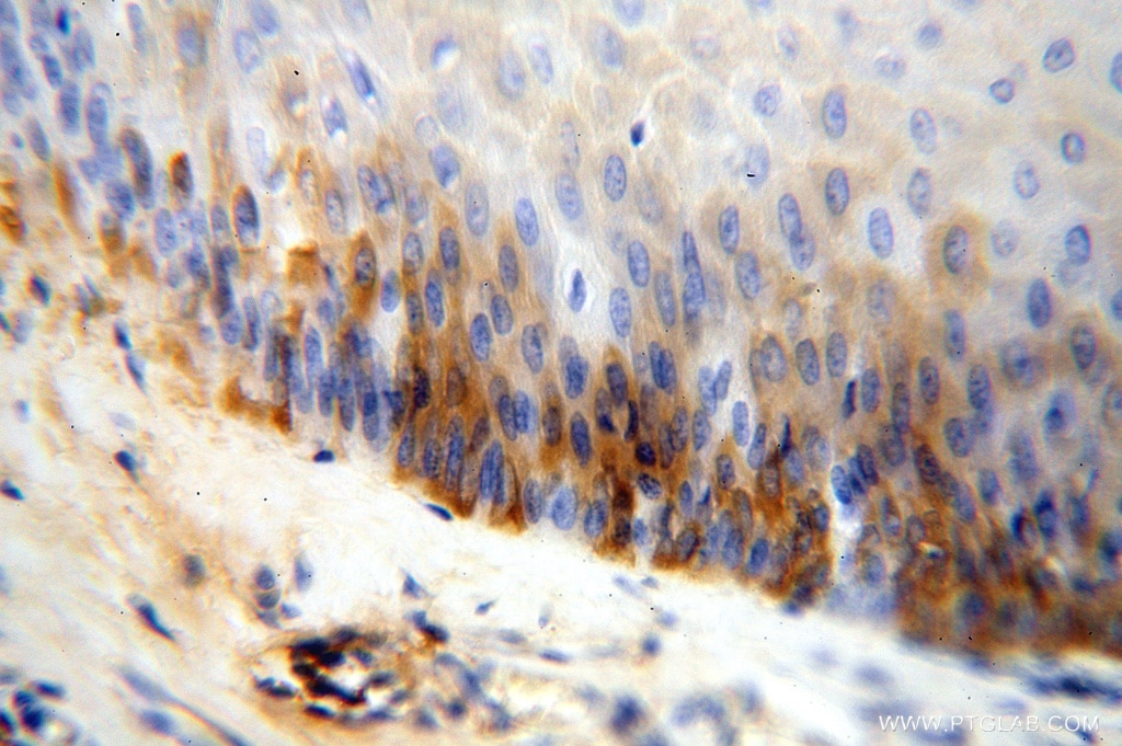 Immunohistochemistry (IHC) staining of human skin tissue using IgG Kappa Light Chain Polyclonal antibody (14678-1-AP)