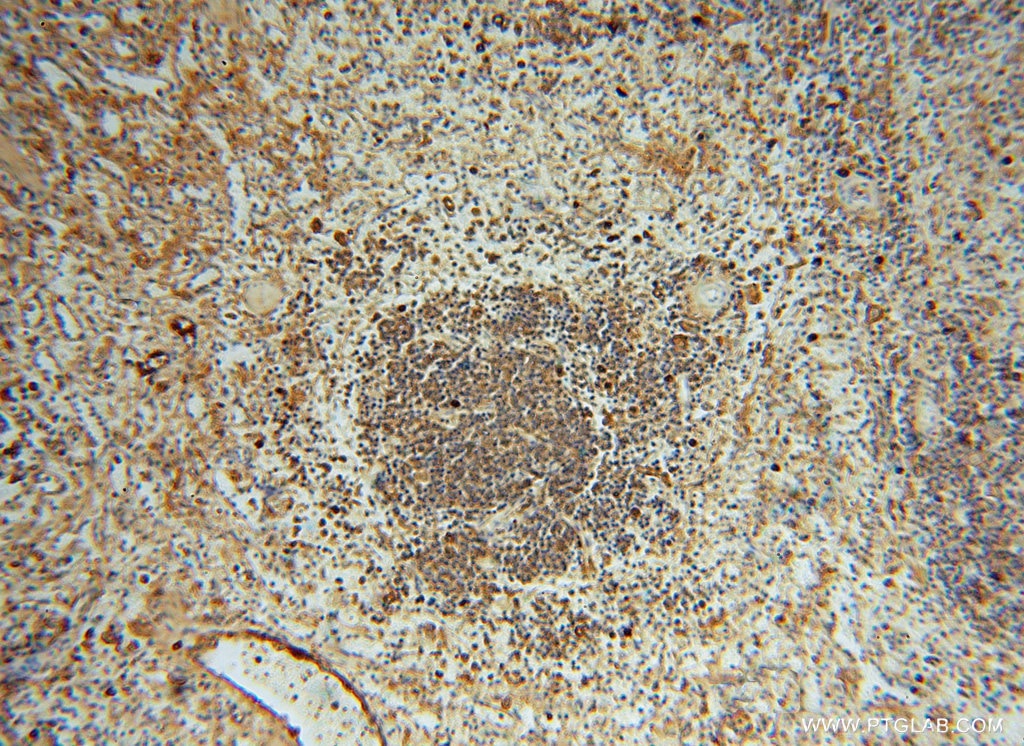 Immunohistochemistry (IHC) staining of human spleen tissue using IgG Kappa Light Chain Polyclonal antibody (14678-1-AP)