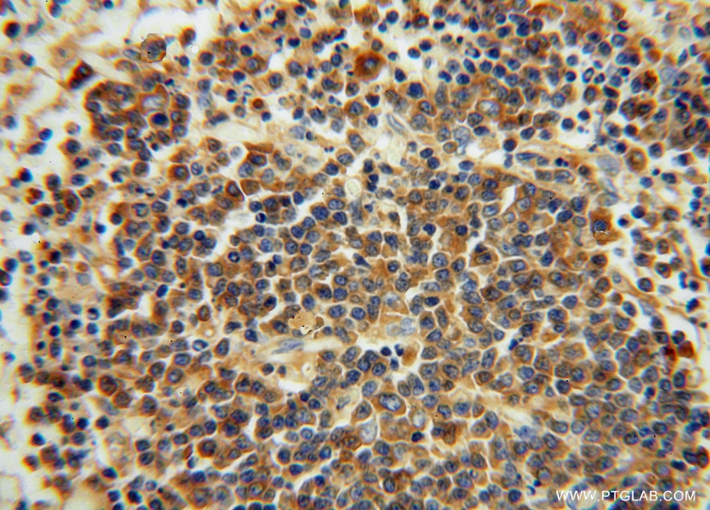 Immunohistochemistry (IHC) staining of human spleen tissue using IgG Kappa Light Chain Polyclonal antibody (14678-1-AP)
