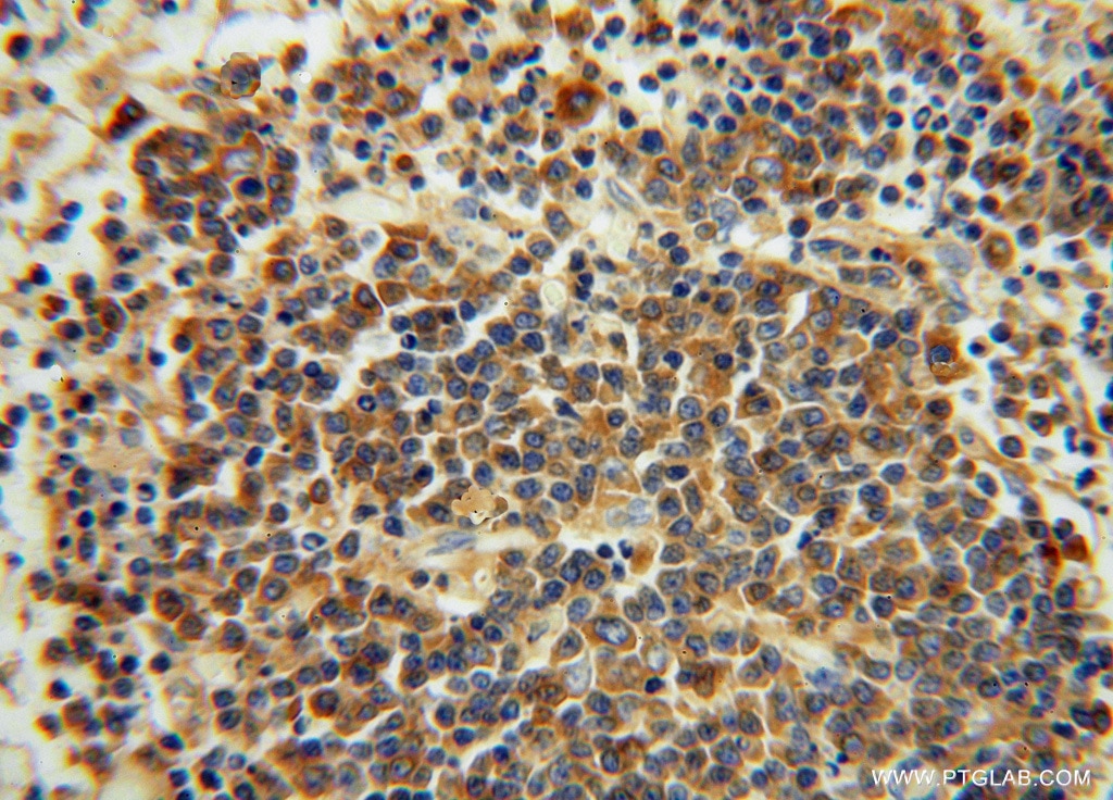 IHC staining of human spleen using 14678-1-AP